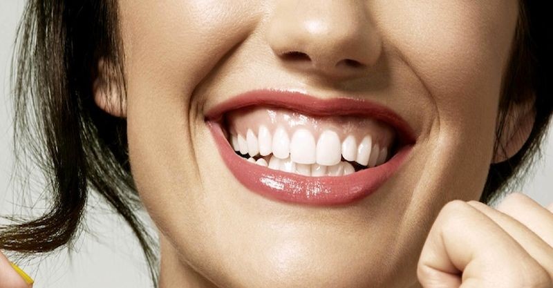 Sorriso Gengival