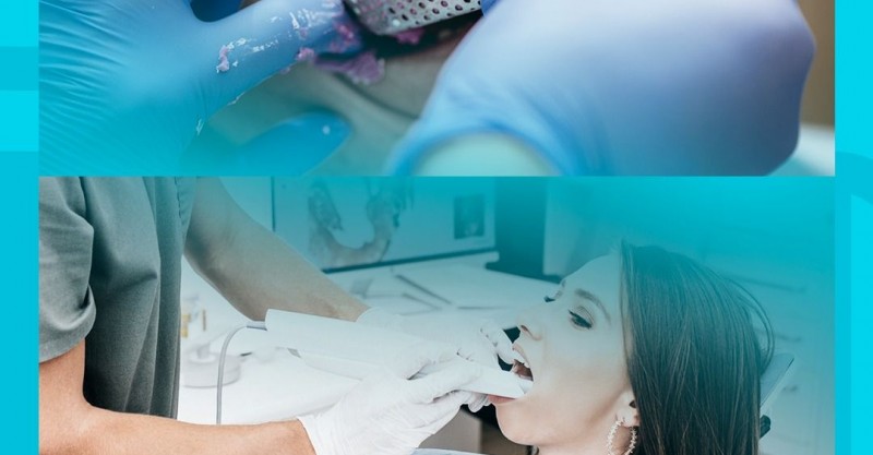 Escaneamento intraoral versus moldagem tradicional: conheça as diferenças