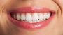 Clareamento Dental: Como é Feito?