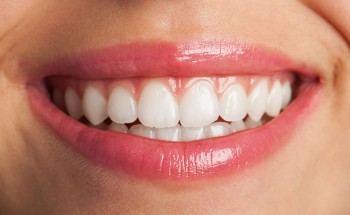 Clareamento Dental: Como é Feito?