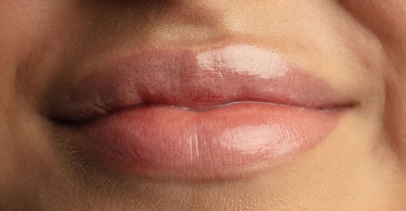 Um Guia Completo Sobre o Preenchimento Labial.